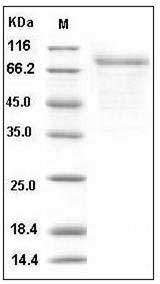 Human CSF2RA / GM-CSFR / CD116 Protein (Fc Tag) SDS-PAGE