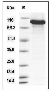 Human ATF2 Protein (His & GST Tag) SDS-PAGE