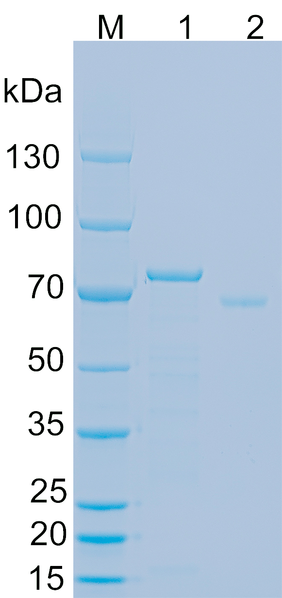 Recombinant Human ZNF746 SDS-PAGE