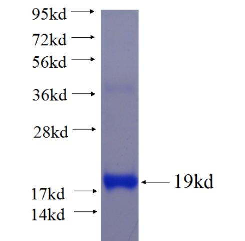 Recombinant human SLC16A9 SDS-PAGE