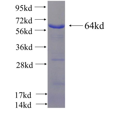 Recombinant Arabidopsis thaliana SDG23 SDS-PAGE