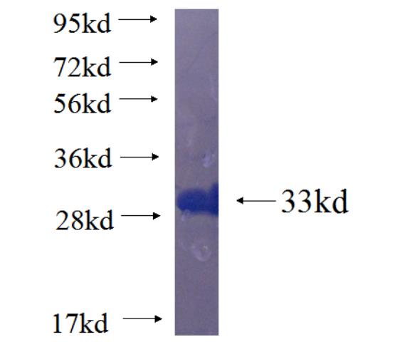 Recombinant human GPM6B SDS-PAGE