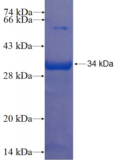 Recombinant Human MUDENG SDS-PAGE