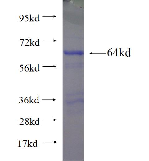 Recombinant human NARS SDS-PAGE