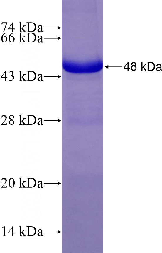 Recombinant Human LIAS SDS-PAGE
