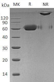 Human TNFRSF11B/OCIF/OPG (Fc tag) recombinant protein