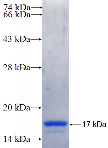 Recombinant Human USP4 SDS-PAGE