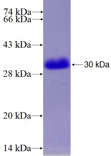 Recombinant Human BOP1 SDS-PAGE