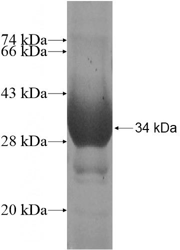 Recombinant Human SLC9A11 SDS-PAGE