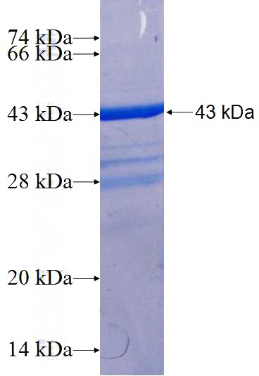 Recombinant Human CIB1 SDS-PAGE