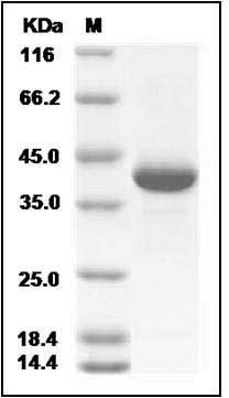 Rat MDHA / MDH1 Protein (His Tag) SDS-PAGE
