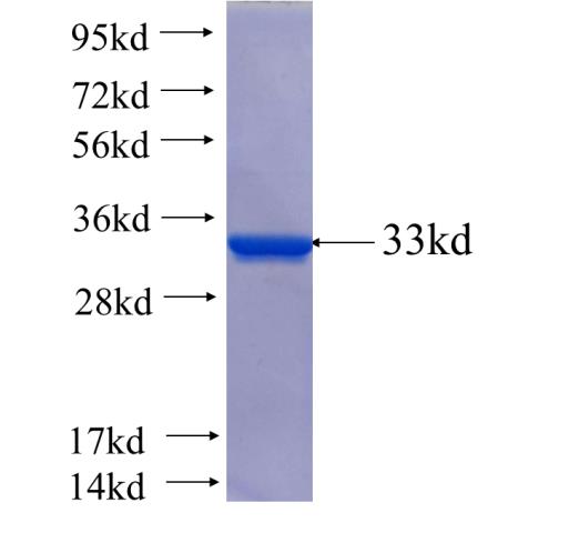 Recombinant human PDLIM5 SDS-PAGE