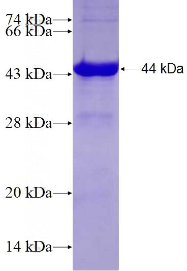 Recombinant Human NDUFAF1 SDS-PAGE