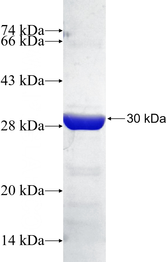 Recombinant Human MRPL40 SDS-PAGE