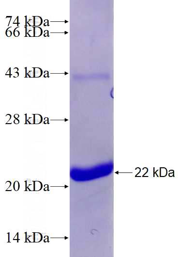 Recombinant Human ETV1 SDS-PAGE
