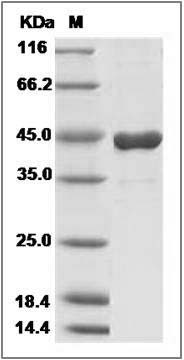 Human ADA / Adenosine deaminase Protein (His Tag) SDS-PAGE