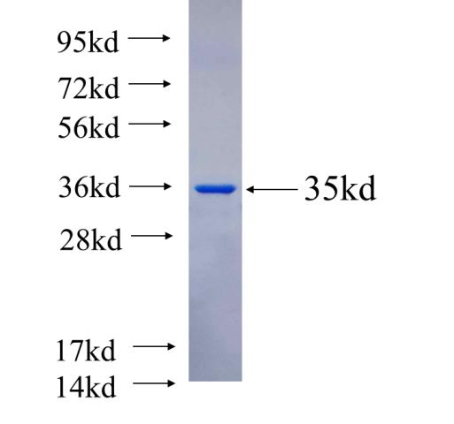 Recombinant human KATNAL1 SDS-PAGE