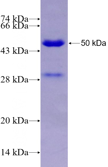 Recombinant Human SOX6 SDS-PAGE