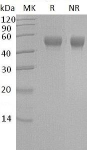 Human LRG1/LRG (His tag) recombinant protein