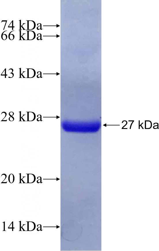 Recombinant Human RHOBTB3 SDS-PAGE