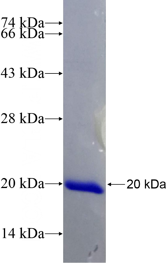 Recombinant Human OPA3 SDS-PAGE