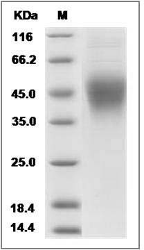 Human FcERI / FCER1A Protein (His Tag) SDS-PAGE