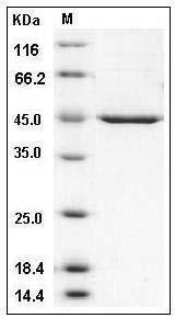 Human PDK-1 (His Tag) recombinant protein