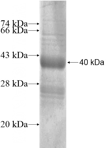 Recombinant Human SLC37A2 SDS-PAGE