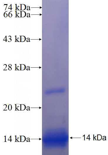 Recombinant Human SLC33A1 SDS-PAGE