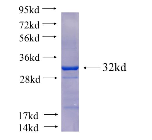 Recombinant human ENDOG SDS-PAGE