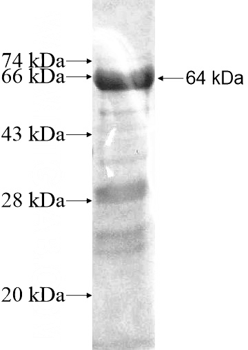 Recombinant Human THAP4 SDS-PAGE