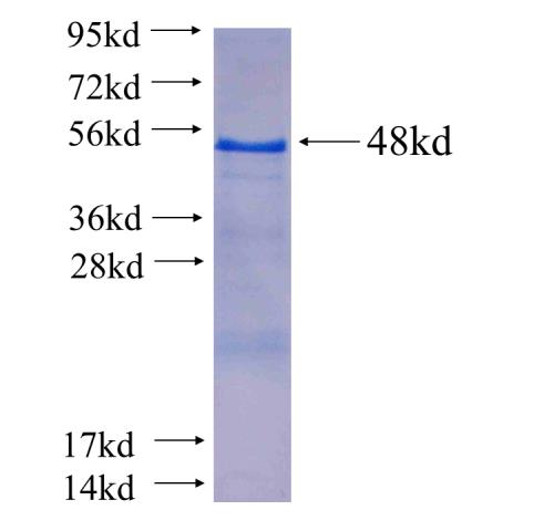 Recombinant human DUSP9 SDS-PAGE