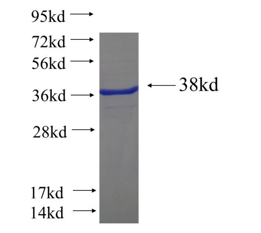Recombinant human ARMCX3 SDS-PAGE