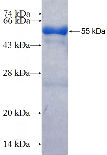 Recombinant Human RARRES1 SDS-PAGE