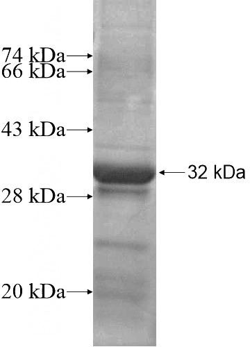 Recombinant Human THAP6 SDS-PAGE