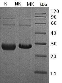 Human TK1 (His tag) recombinant protein