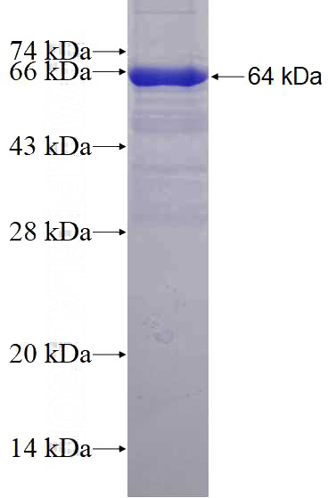 Recombinant Human MPP6 SDS-PAGE