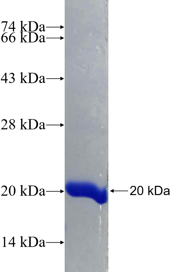 Recombinant Human MUM1 SDS-PAGE