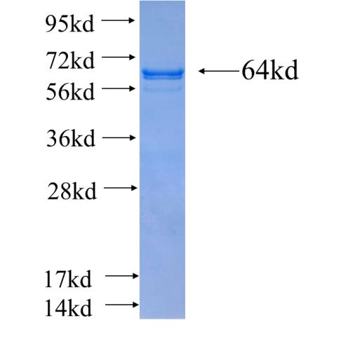 Recombinant human SMARCA5 SDS-PAGE