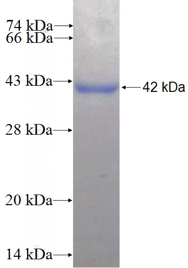 Recombinant Human PCDHB15 SDS-PAGE