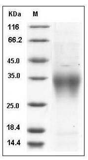 Mouse CD28 Protein (His Tag) SDS-PAGE