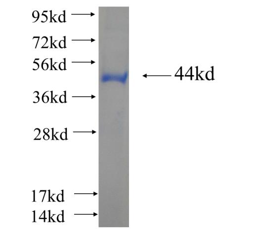 Recombinant human TTC30B SDS-PAGE