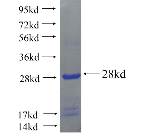 Recombinant human FAHD1 SDS-PAGE