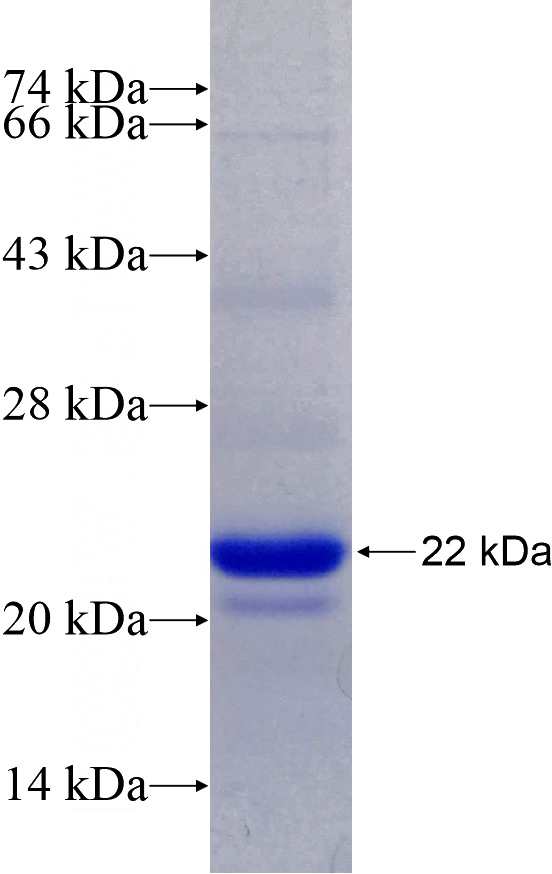 Recombinant Human PRKDC SDS-PAGE