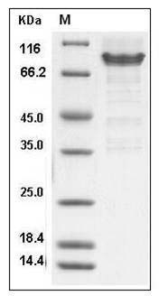 Mouse PSGL-1 / CD162 / SELPLG Protein (Fc Tag) SDS-PAGE