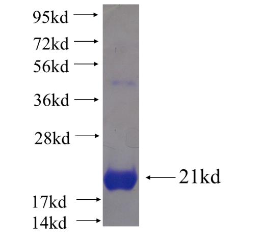 Recombinant human RPS19BP1 SDS-PAGE