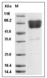Rat EDAR Protein (Fc Tag) SDS-PAGE
