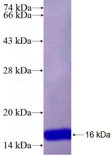 Recombinant Human RHOU SDS-PAGE
