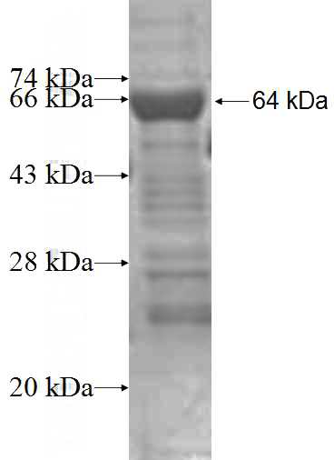 Recombinant Human NDC80 SDS-PAGE
