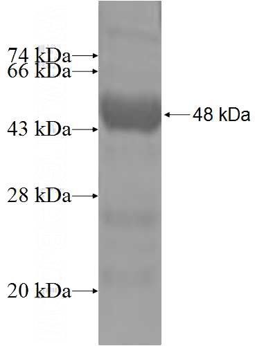 Recombinant Human NKIRAS1 SDS-PAGE